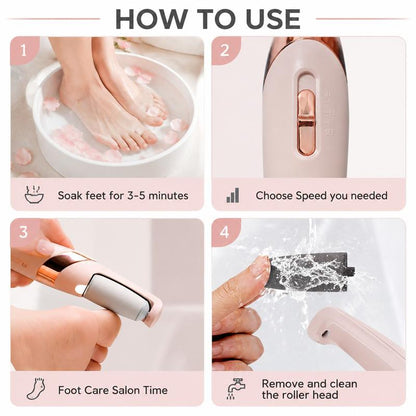 Feety™ Callus Remover